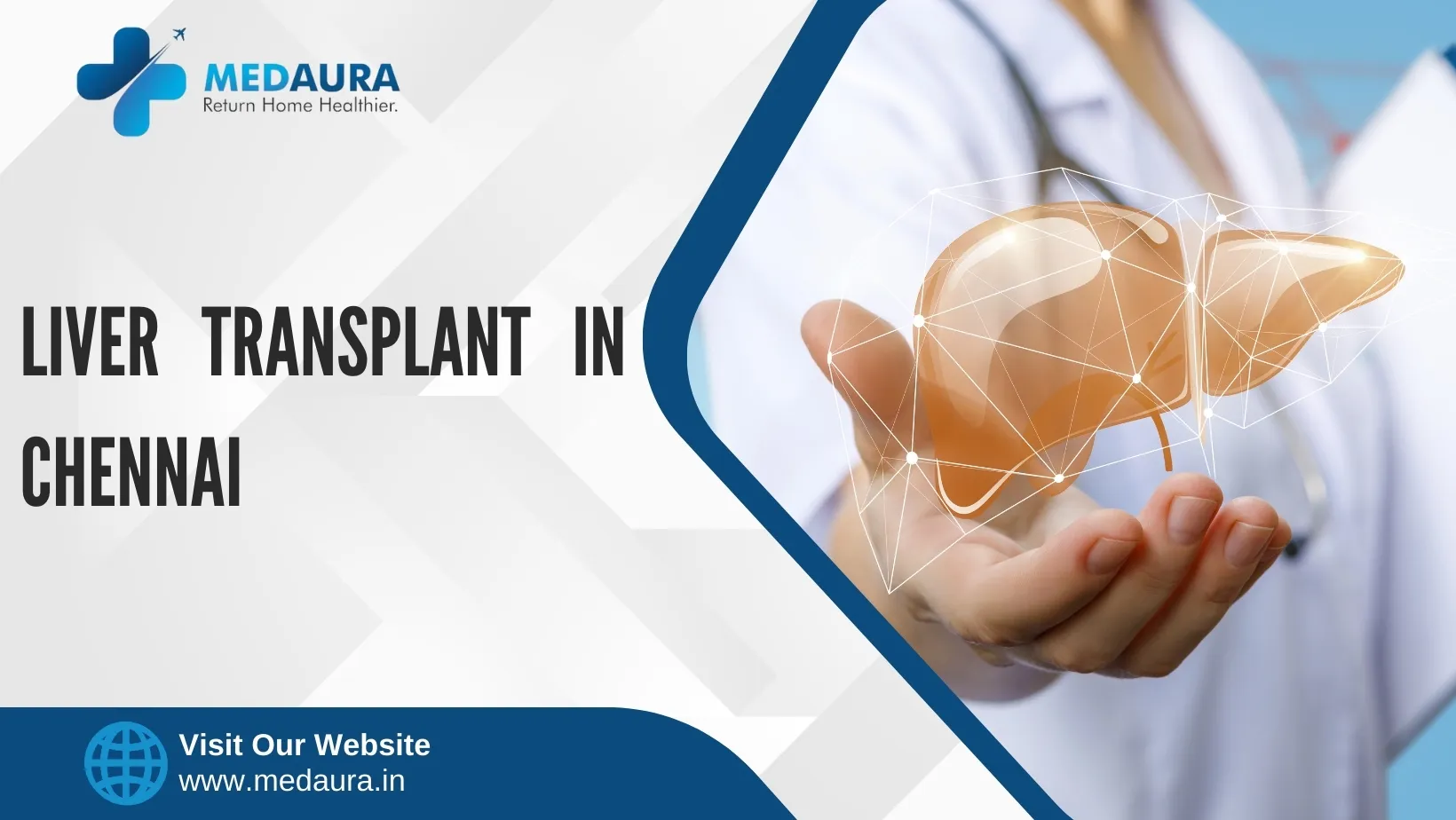 Liver Transplant in Chennai