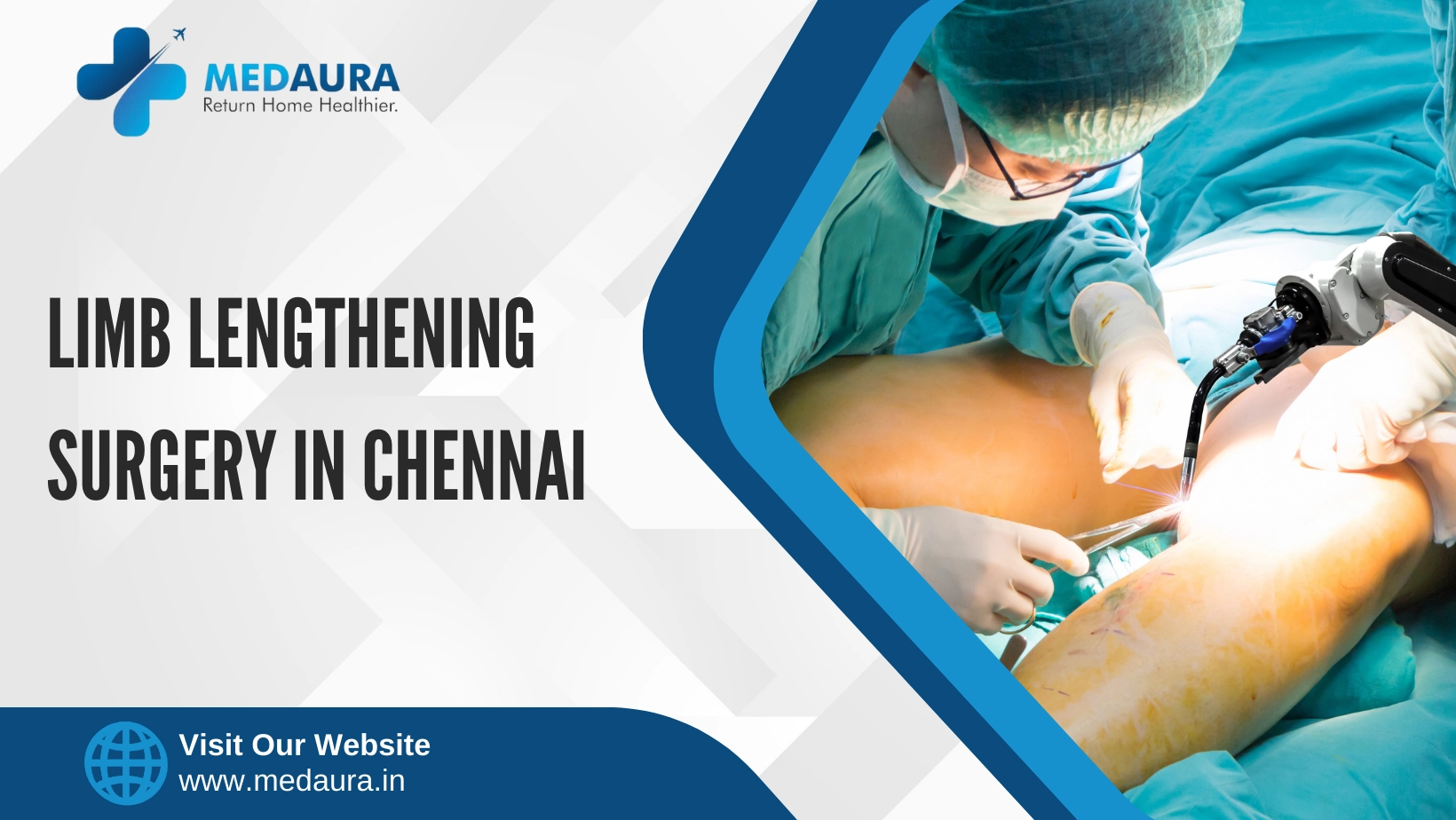 Limb Lengthening Surgery in Chennai